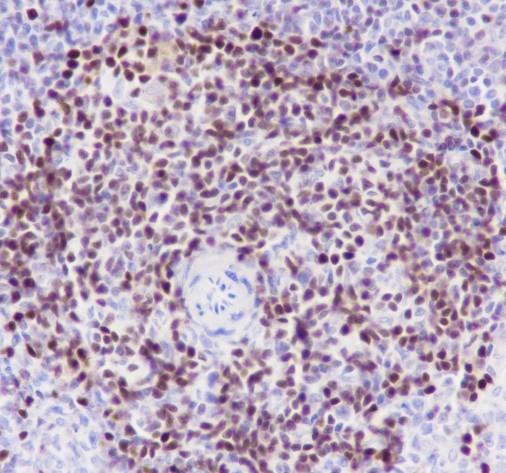 Recombinant SATB1 Monoclonal Antibody - small - 4