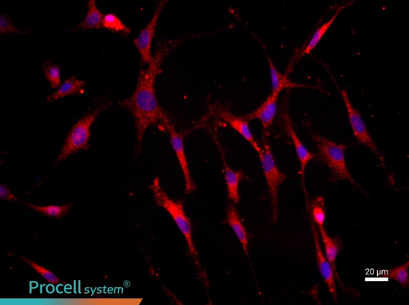 Mouse Articular ChondrocytesMouse Articular Chondrocytes - 2