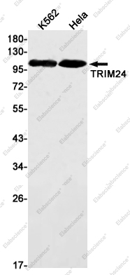 Recombinant TRIM24 Monoclonal Antibody - 1