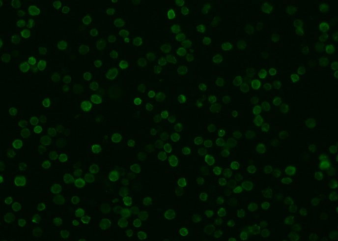 Recombinant IBA1/AIF1 Monoclonal Antibody - small - 3