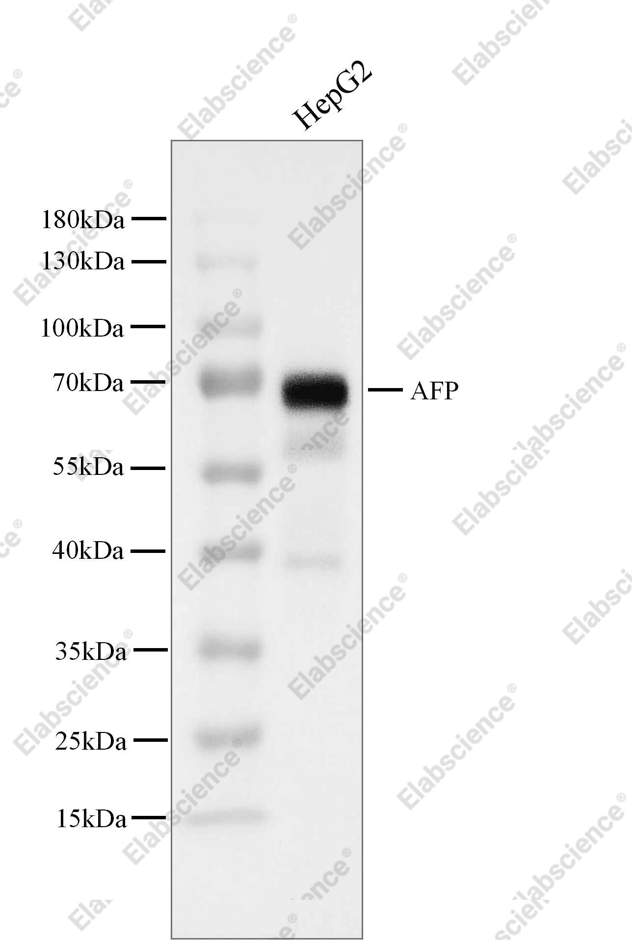 Recombinant AFP/alpha-fetoprotein Monoclonal Antibody - 1