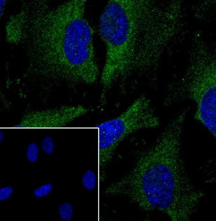 Recombinant IKB beta Monoclonal Antibody-searchlist-2
