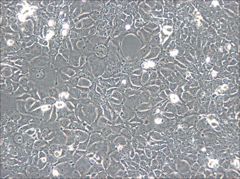 KYSE-140 Cell Complete Medium - 6