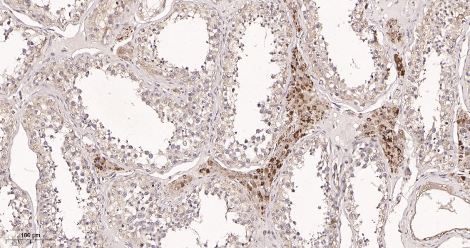 Recombinant ROCK1 Monoclonal Antibody - small - 2