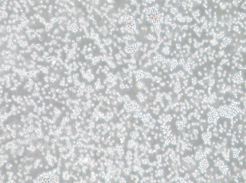 SU-DHL-6 Cell Complete Medium - 2