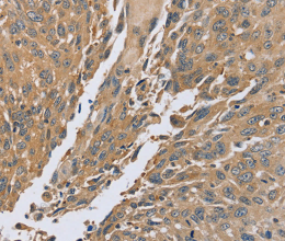 PTPN12 Polyclonal Antibody - 2