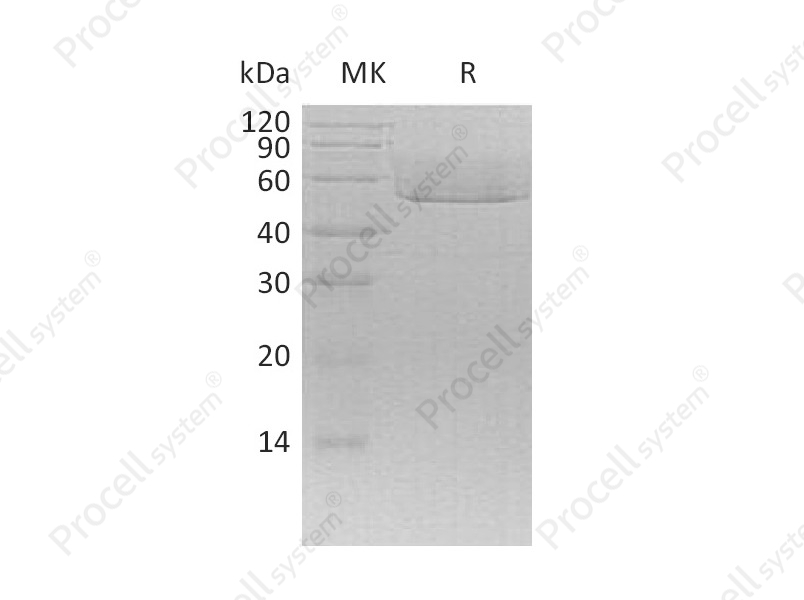 Fractalkine/CX3CL1 (C-6His), Mouse, Recombinant
