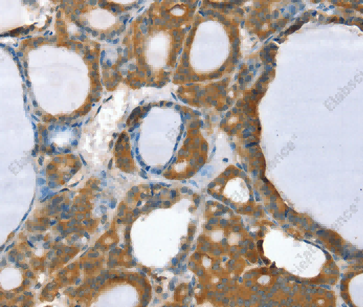PPP2CA Polyclonal Antibody - 2