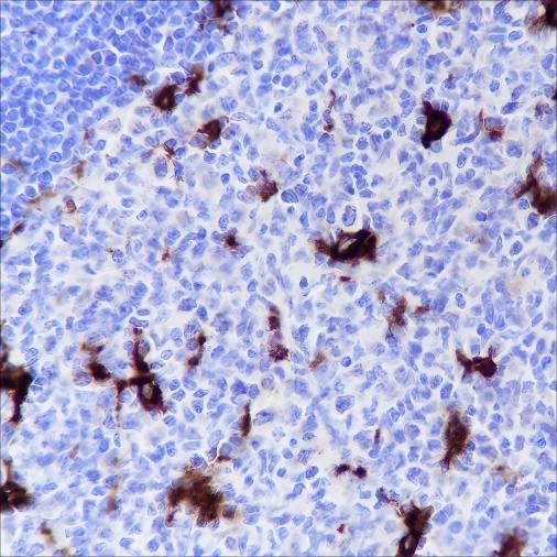 Recombinant GPNMB Monoclonal Antibody - small - 2