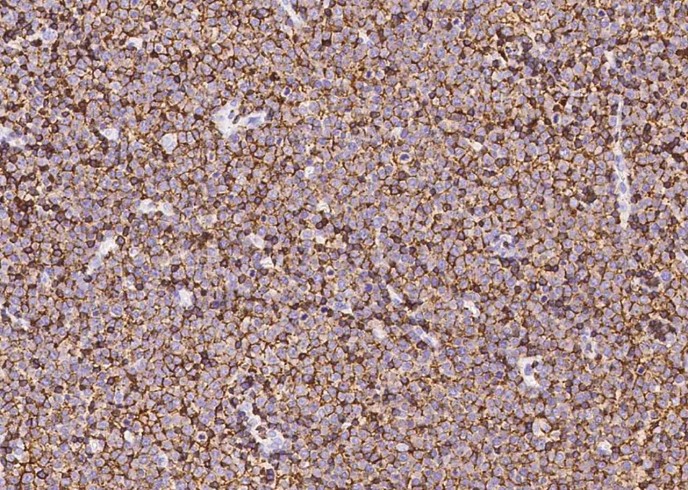 Recombinant CD45/PTPRC Monoclonal Antibody - small - 2