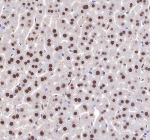 Recombinant APE1 Monoclonal Antibody - small - 3