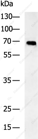 ALB Polyclonal Antibody - 1