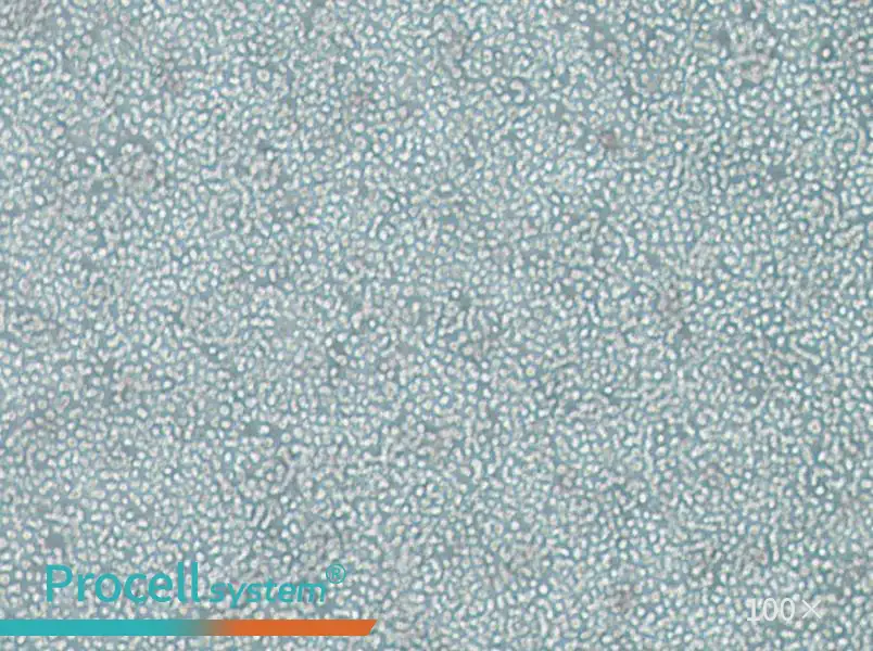 SKNO-1 Cell Complete MediumSKNO-1 Cell Complete Medium - 3