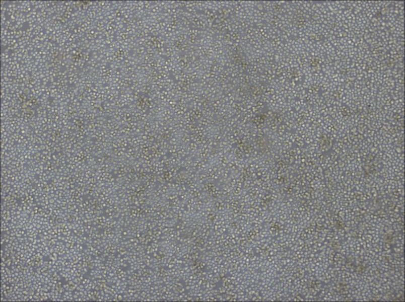 DoHH2 Cell Complete MediumDoHH2 Cell Complete Medium - 2