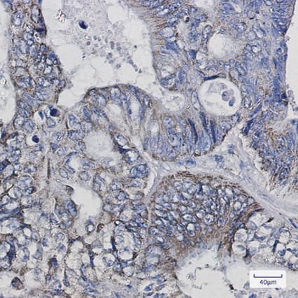 Recombinant Thioredoxin-2/TXN2 Monoclonal Antibody - 3