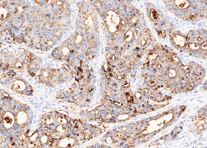 Recombinant CEACAM5/CD66e Monoclonal Antibody - small - 2