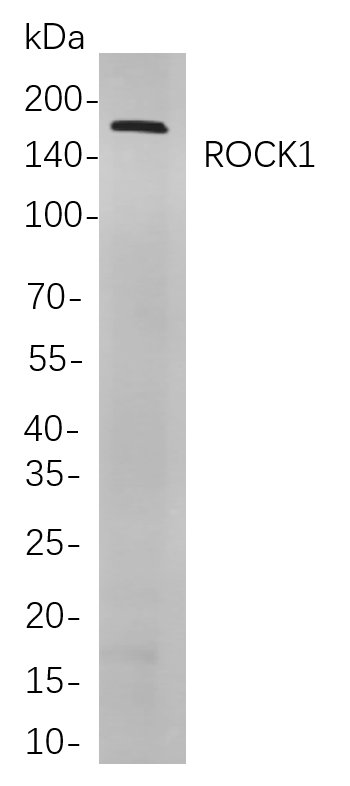 Recombinant ROCK1 Monoclonal Antibody-searchlist-1