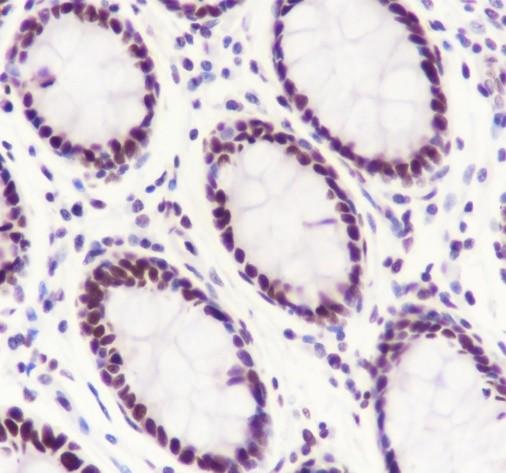 Recombinant SA2 Monoclonal Antibody - 2