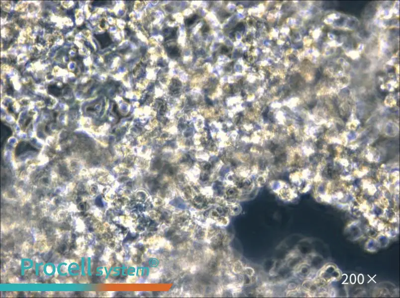 NCI-H526 Cell Complete Medium - 5