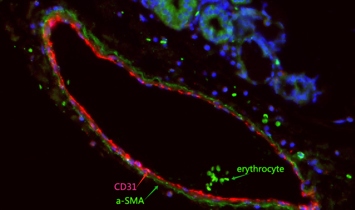 Recombinant α smooth muscle actin Monoclonal Antibody - small - 8