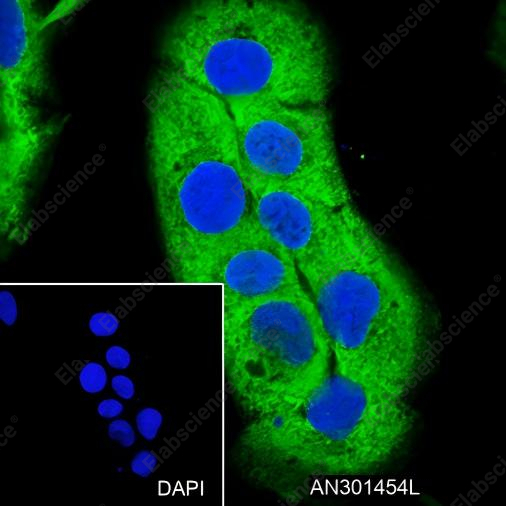 Recombinant Calpastatin Monoclonal Antibody - 3