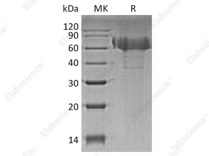 Recombinant Human TIM4/TIMD4 Protein (His Tag) - 1
