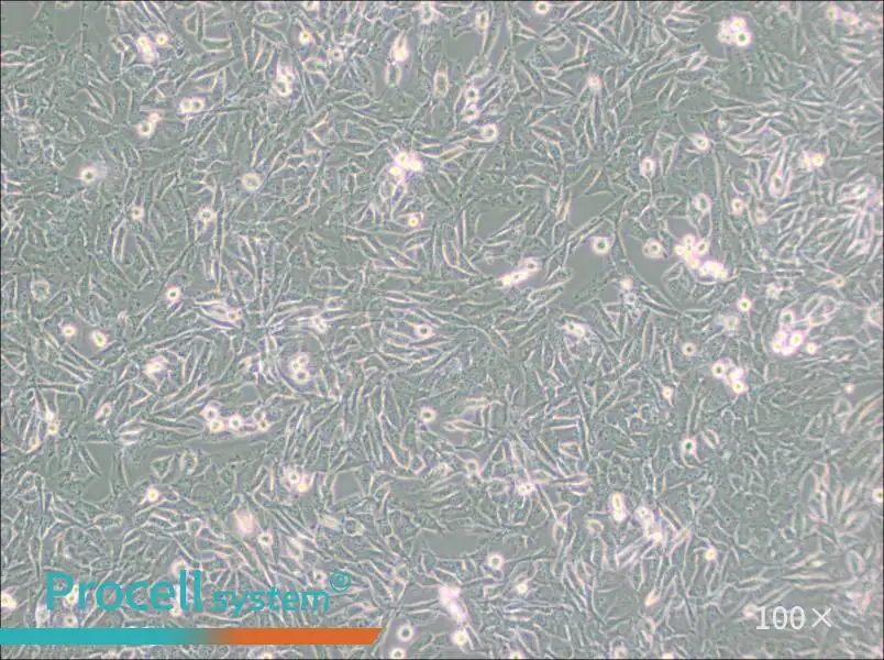 UM-UC-3 Cell Complete Medium - 1
