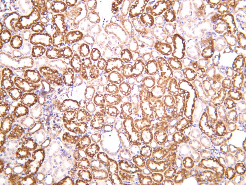 Recombinant SOD2 Monoclonal Antibody - small - 5