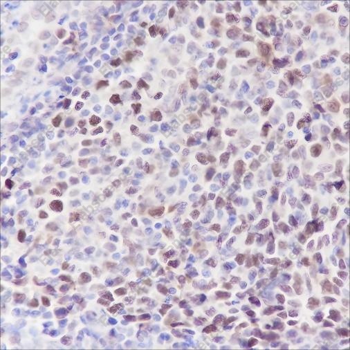Recombinant MCM5 Monoclonal Antibody - 2