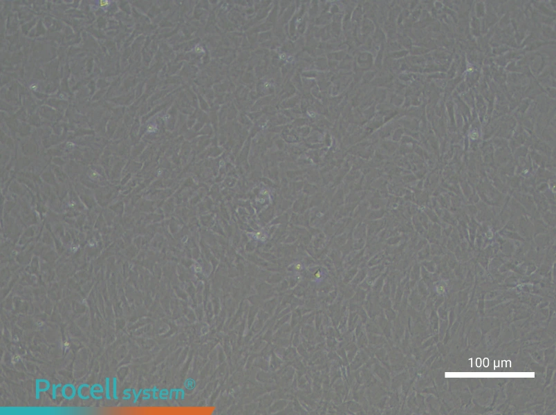 Rat Bronchial Fibroblast Complete Medium - 1