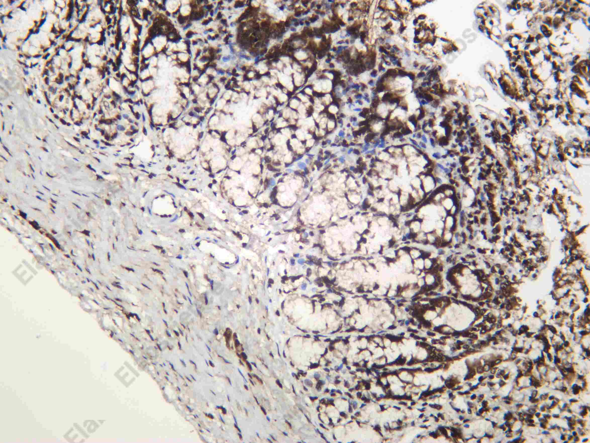 Recombinant Dyskerin Monoclonal Antibody - 4
