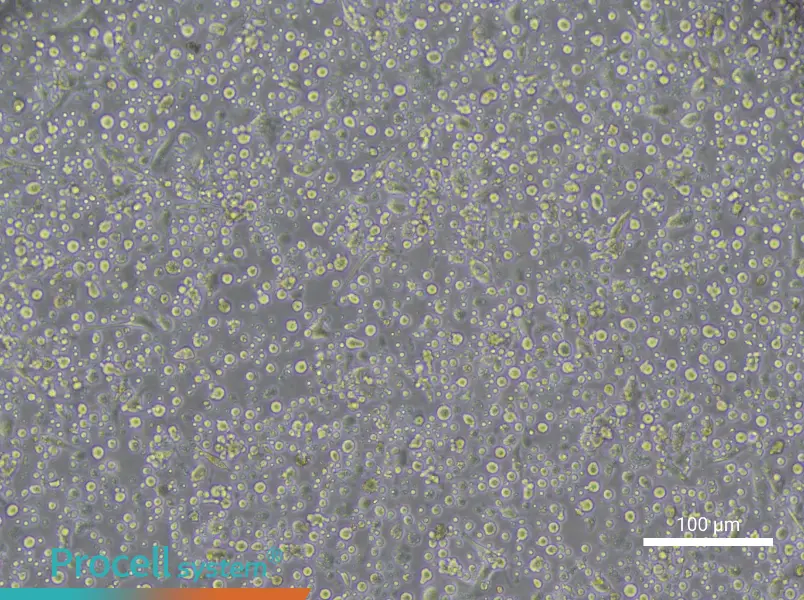 Human Peripheral Blood Maturation Dendritic cell Complete Medium - 1