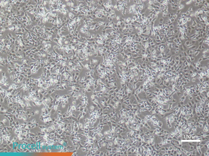 Rat Aortic Endothelial (Primary cell immortalization) Cell Complete MediumRat Aortic Endothelial (Primary cell immortalization) Cell Complete Medium - 3