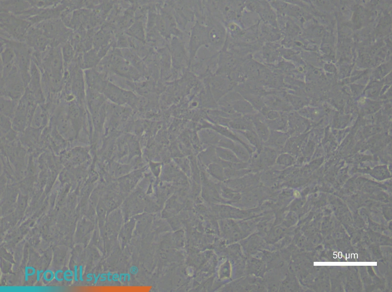Rat Aortic Adventitial FibroblastsRat Aortic Adventitial Fibroblasts - 5