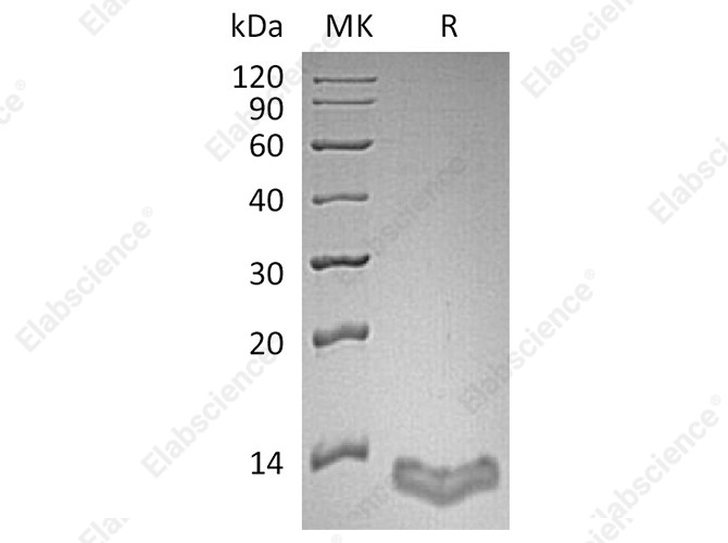Recombinant Human S100A16/S100F Protein - 1