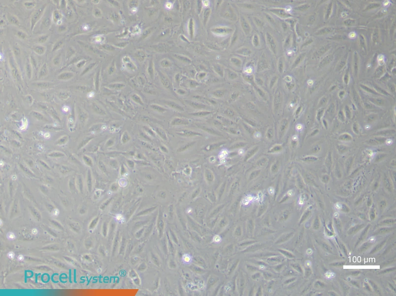 Human Endometrial Epithelial (Primary cell immortalization) Cell Complete MediumHuman Endometrial Epithelial (Primary cell immortalization) Cell Complete Medium - 3