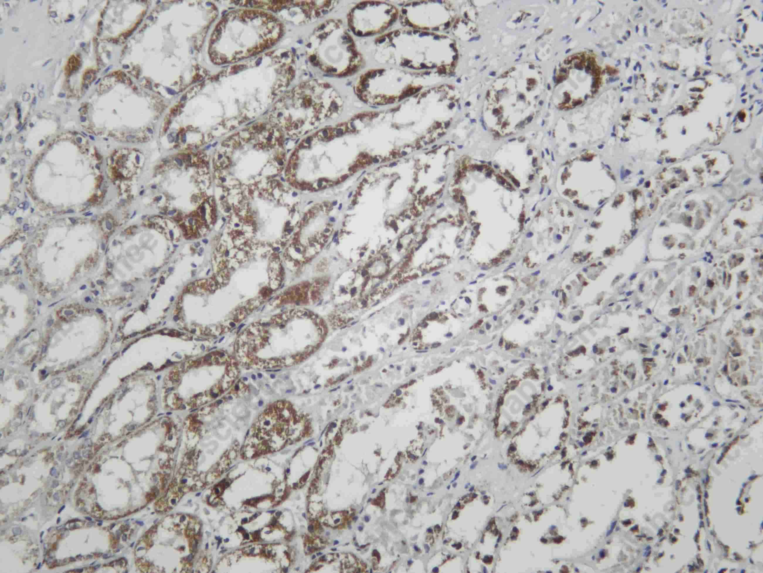 Recombinant SGK1 Monoclonal Antibody - 1