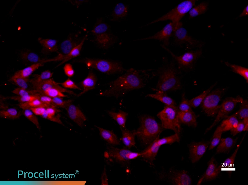 Human Intervertebral Disc Nucleus Pulposu Cell Complete Medium - 2