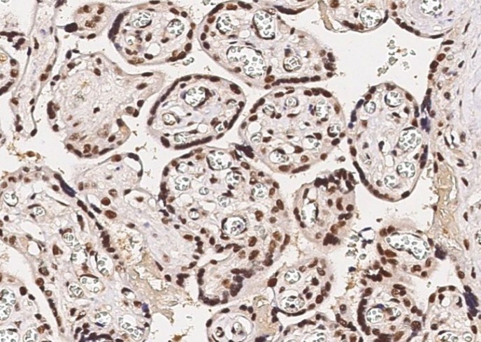 Recombinant HSF1 Monoclonal Antibody - small - 3