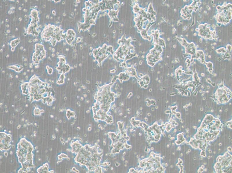 NCI-H209 [H209] Cell Complete Medium - 2