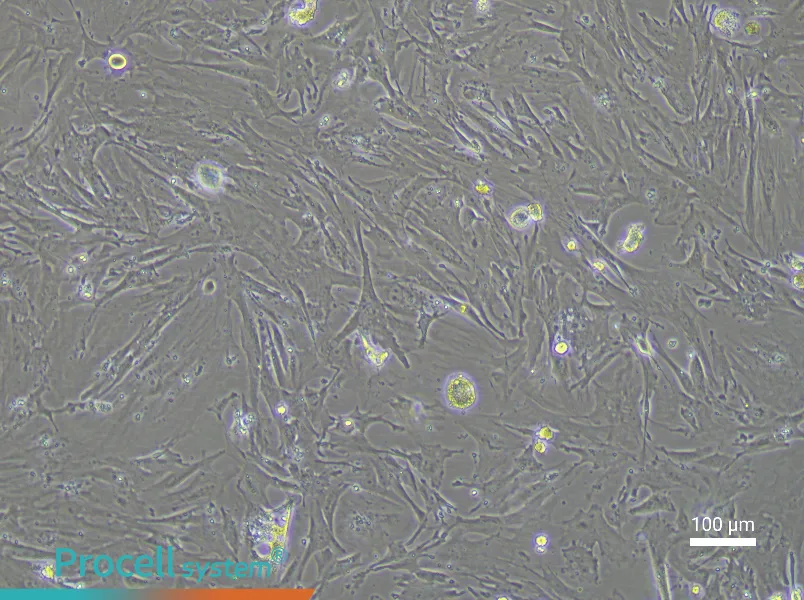 Mouse Mammary Fibroblast Complete Medium - 1