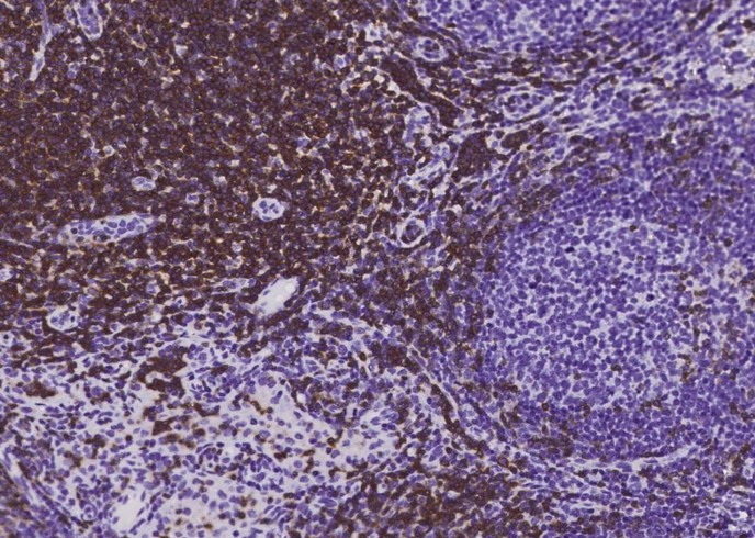 Recombinant CD3D & CD3E Monoclonal Antibody - small - 3