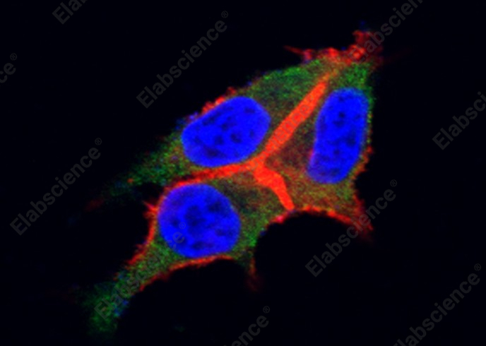 G-CSFR/CD114/CSF3R Monoclonal Antibody - 1