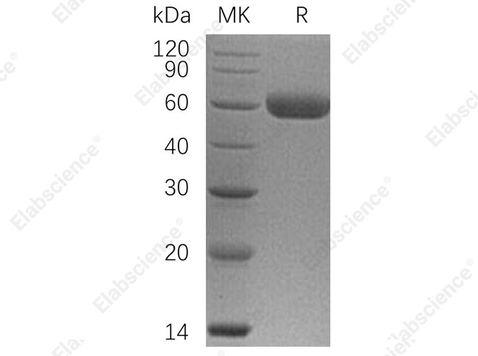 Recombinant Human Osteoprotegerin/TNFRSF11B Protein (His Tag) - 1