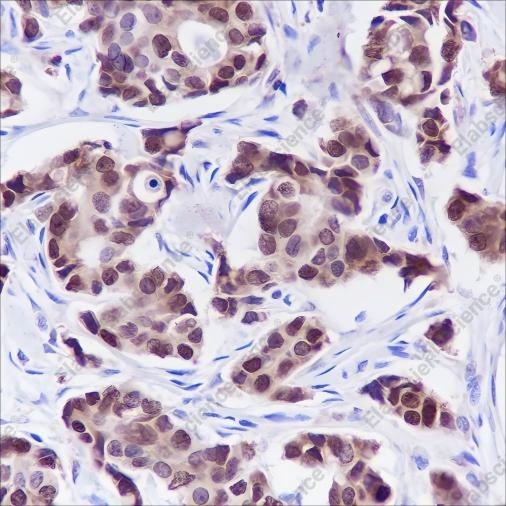 Recombinant FOXA1 Monoclonal Antibody - 2