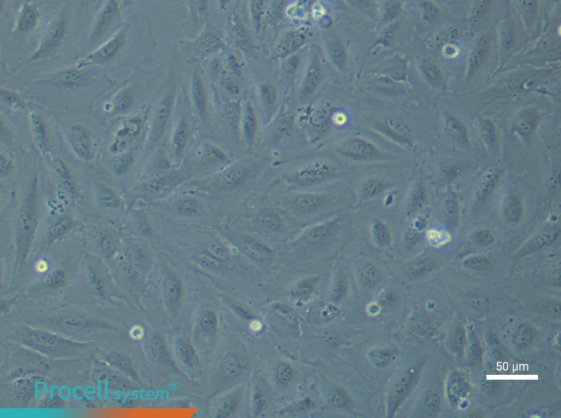 Human Endometrial Epithelial (Primary cell immortalization) Cell Complete MediumHuman Endometrial Epithelial (Primary cell immortalization) Cell Complete Medium - 4