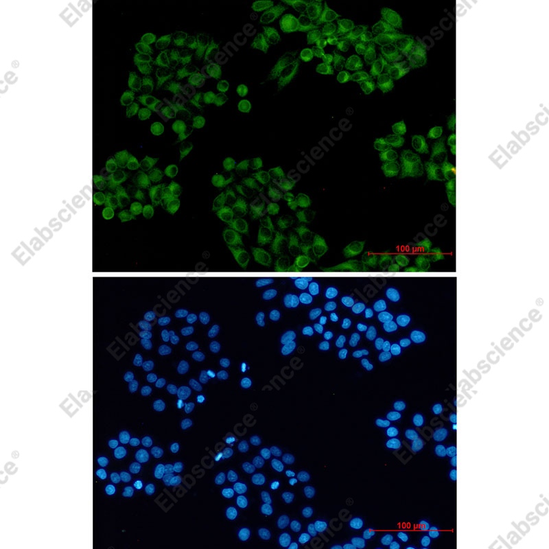 Recombinant Cellubrevin Monoclonal Antibody - 2