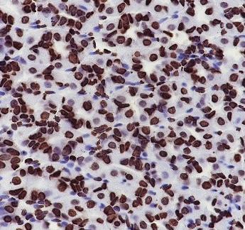Recombinant Histone H4 (CT) Monoclonal Antibody - small - 7