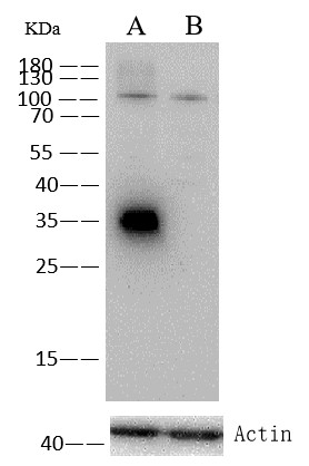 CD20/MS4A1 Monoclonal Antibody - small - 4