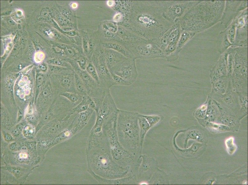 MKN-7 [MKN7; MKN 7] Cell Complete Medium - small - 4